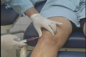 El tratamiento consiste en la infiltración de estas células en la rodilla.