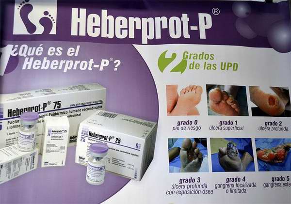 cuba, salud publica, heberprot-p, pie diabetico