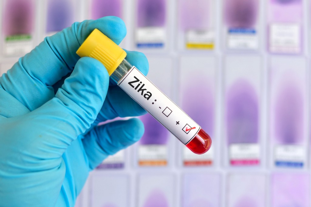 El laboratorio del IPK diagnosticó el positivo para virus de Zika.