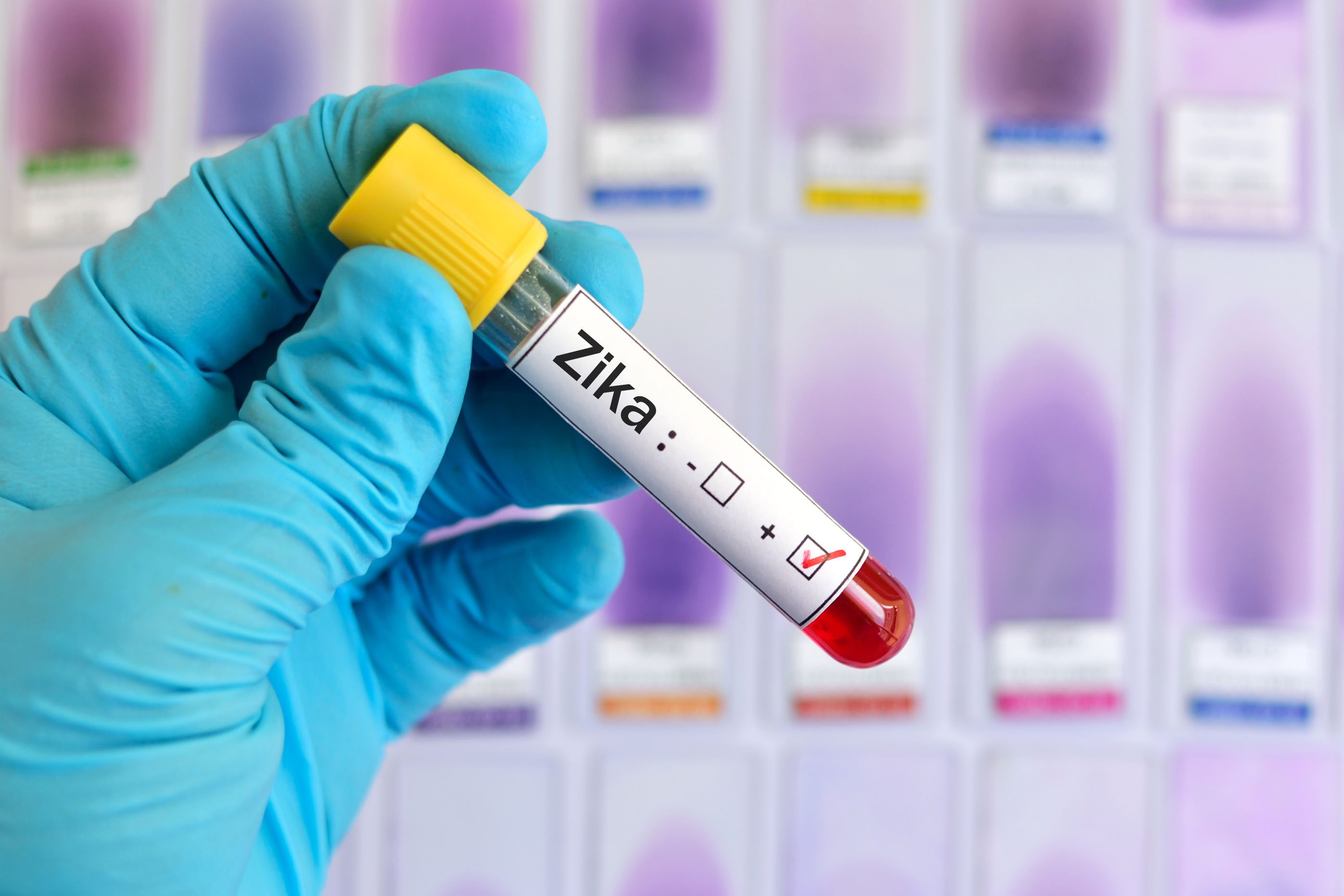 El laboratorio del IPK diagnosticó el positivo para virus de Zika.