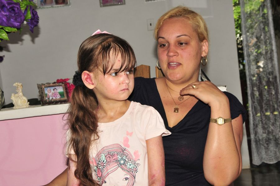 sancti spiritus, salud publica, dermatologia, epidermólisis bullosa