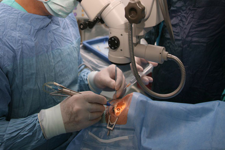 Los oftalmólogos cubanos realizaron gratuitamente casi 141 mil consultas y unas 23 mil operaciones. 