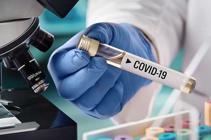 Camagüey realizó la pasada semana 350 PCR; todos resultaron negativos al SARS-CoV-2