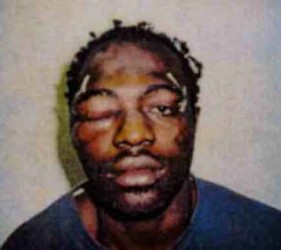 Rodney King, el hombre que fue víctima del caso de brutalidad policial más sonado en la historia de Los Angeles.