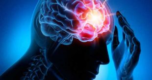 cuba, cigb, enfermedades cerebrovasculares, neurologia, infarto cerebral