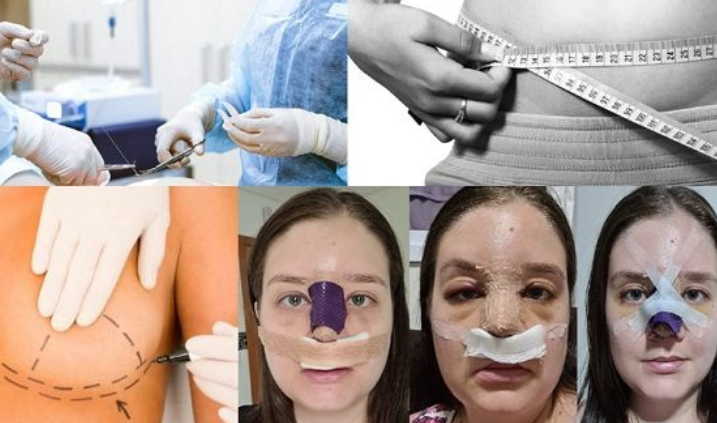 Los brasileños son asiduos a las cirugías estéticas – Escambray